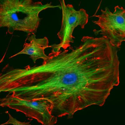  Endothelial cells under the microscope. Nuclei are stained blue with DAPI, microtubles are marked green by an antibody bound to FITC and actin filaments are labelled red with phalloidin bound to TRITC. Bovine pulmonary artery endothelial cells (This is a file from the Wikimedia Commons.)